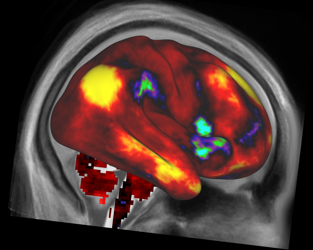 effects of cannabinoids on the brain